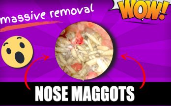 EPIC EAR TICK REMOVAL!!! MUST WATCH VIDEO BEFORE YOU DIE