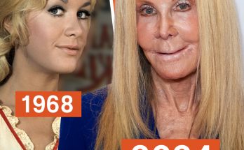 Fans Regret Joan Van Ark's Decision to Use Plastic Surgery – Her Transformation in Photos