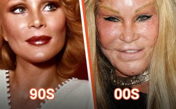 Billionaire 'Catwoman' Jocelyn Wildenstein Claims She Never Had Any Plastic Surgery — She Speaks Out About Why Her Face 'Swelled Up'