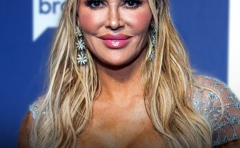 Users Suspect Bravo Star Brandi Glanville Has Health Issues with Her Face Due to 'Removed Fillers' - Photo