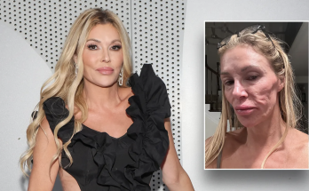 Brandi Glanville spending 'all of my money' looking for answers to mystery illness that left her disfigured