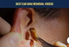 Perforating polyp in the ear canal.|ear wax removal | ear cleaning | ASMR | relaxation | relax