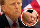 'Huge' Bruise on Donald Trump's Hand Sparks Health Concerns