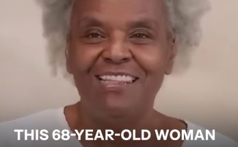 A Surgeon Son Performed Plastic Surgery on His 68-Year-Old Mom, Who Was Amazed by the Results — Before & After Photos Stun