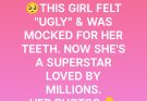 This Girl Hated Her Body and Felt 'Ugly' – at 31, She's a Top Star, but Still Gets Mocked for Her Teeth