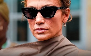 Jennifer Lopez, 55, Reveals She Got Facial Stitches – Details