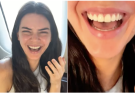 Kendall Jenner Reveals She Chipped a Tooth Ahead of Watching the Knicks with Kylie Jenner and Timothée Chalamet: 'No Way!'