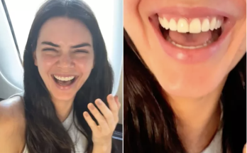 Kendall Jenner Reveals She Chipped a Tooth Ahead of Watching the Knicks with Kylie Jenner and Timothée Chalamet: 'No Way!'