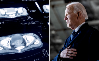 Gleason score for prostate cancer: What to know about Biden's diagnosis