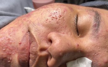 Relaxing Skincare Routine