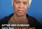She Had Facial Tumors Since Childhood & After Surgery, Netizens Are in Awe of Her Look – 5 More Inspiring Cosmetic Stories