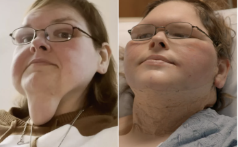 1000-Lb. Sisters’ Tammy Slaton Faces Her Fears, Gets Skin Removal Surgery: 'Seriously Freaking Terrified' (Exclusive)