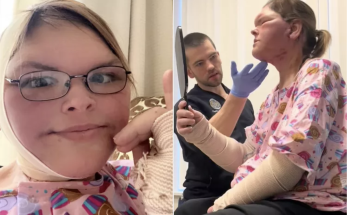 1000-Lb. Sisters’ Tammy Slaton Shares New Photos of Swollen Face and Surgery Scars After 15-Lb. Skin Removal